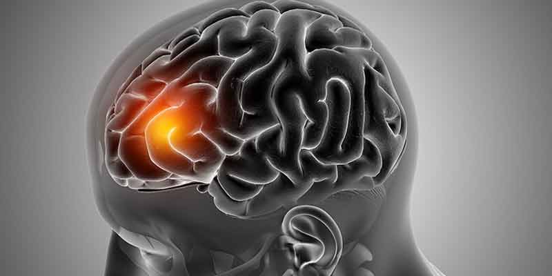 IBRAIN STROKE: WORLDWIDE PROBLEM IN BRAIN